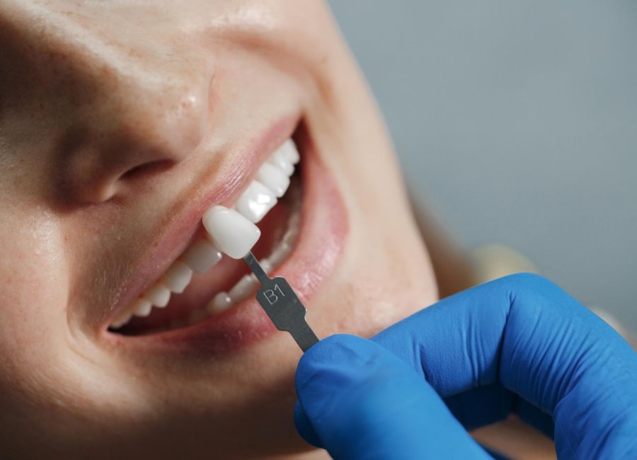 Zirconium Restorations