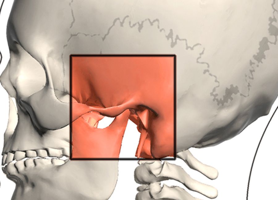 Treatment of Temporomandibular Joint Disorders