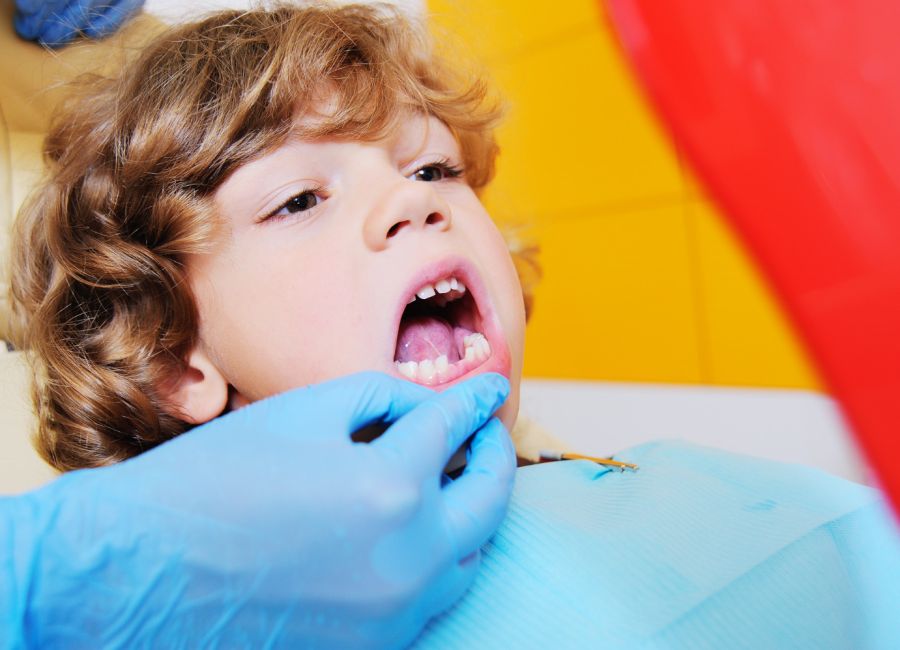 Süt Dişi Amputasyon Tedavisi