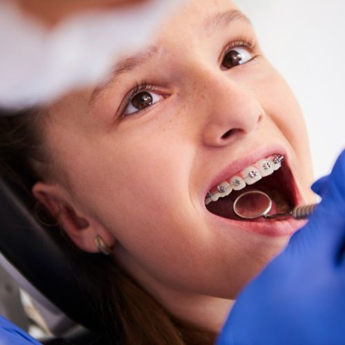 Fixed Orthodontic Treatments