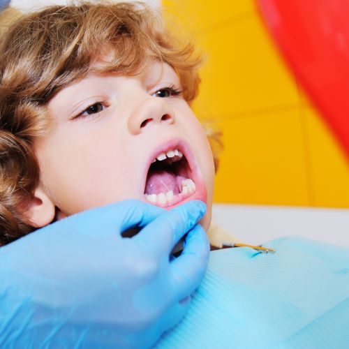 Süt Dişi Amputasyon Tedavisi