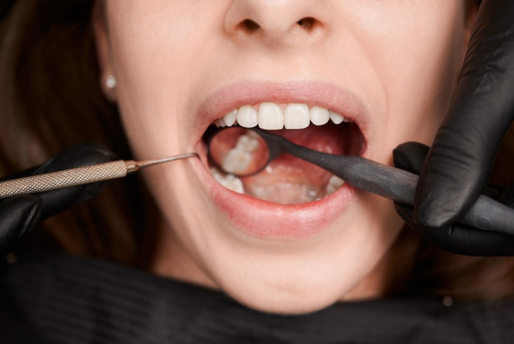 Periodontal Treatments
